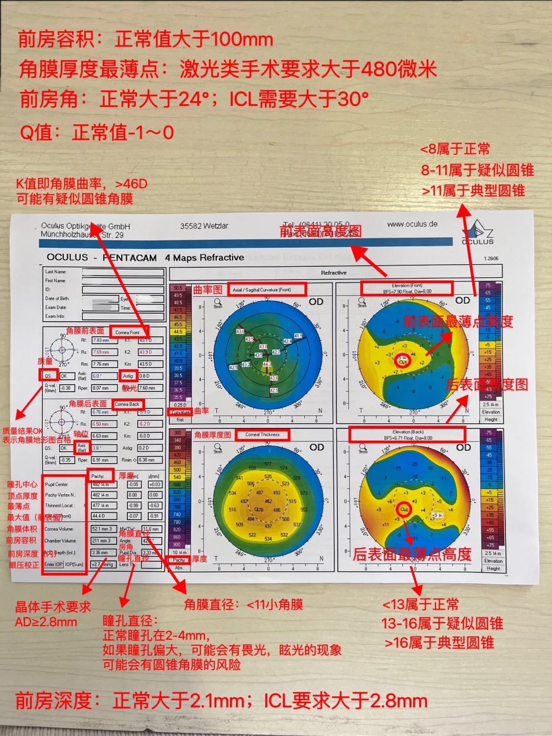 一张图带你看懂角膜地形图的数据‼️_1_小爱护眼日记_来自小红书网页版